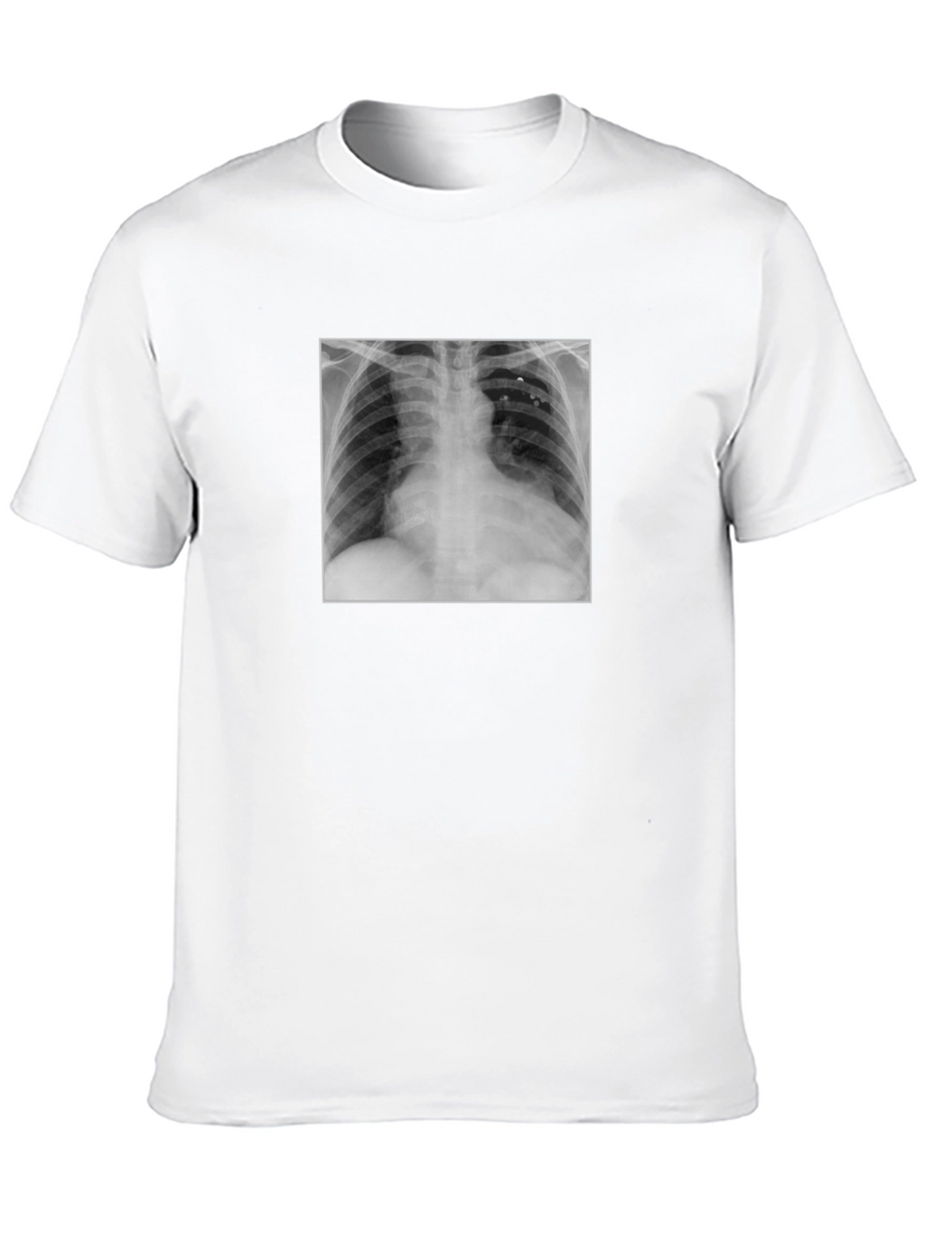 X-Ray Graphic Tee - Medical Humor T-Shirt
