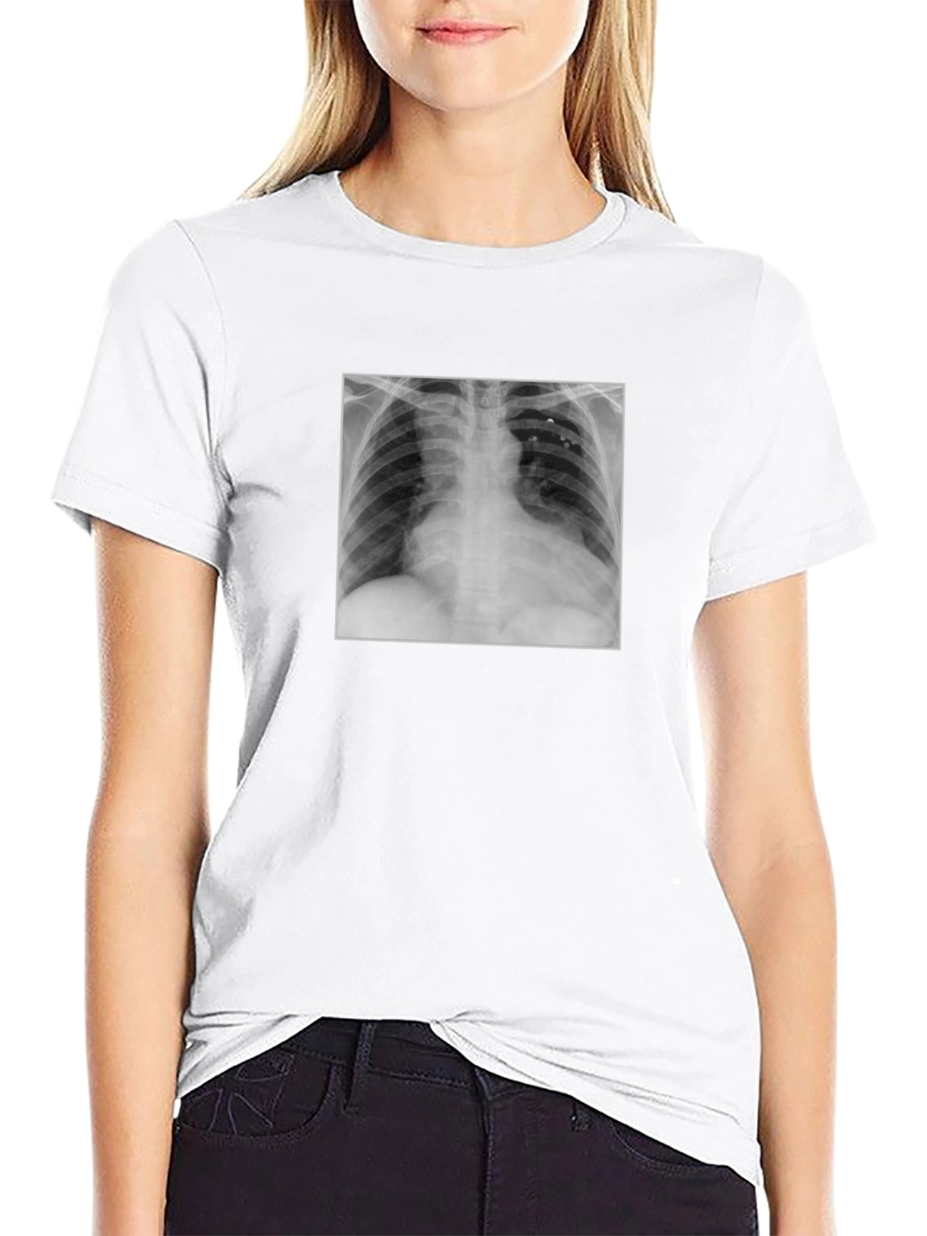 X-Ray Graphic Tee - Medical Humor T-Shirt