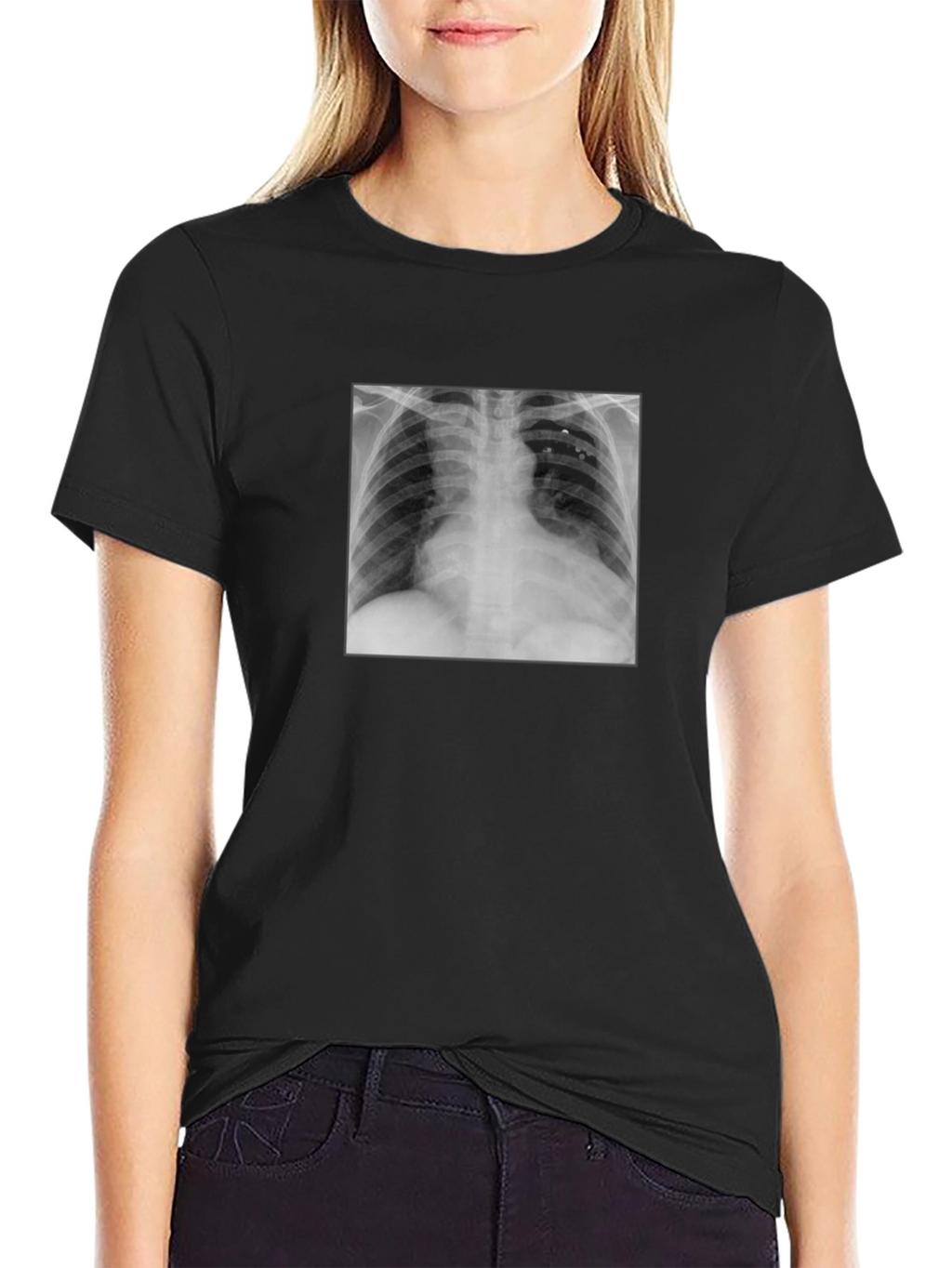 X-Ray Graphic Tee - Medical Humor T-Shirt