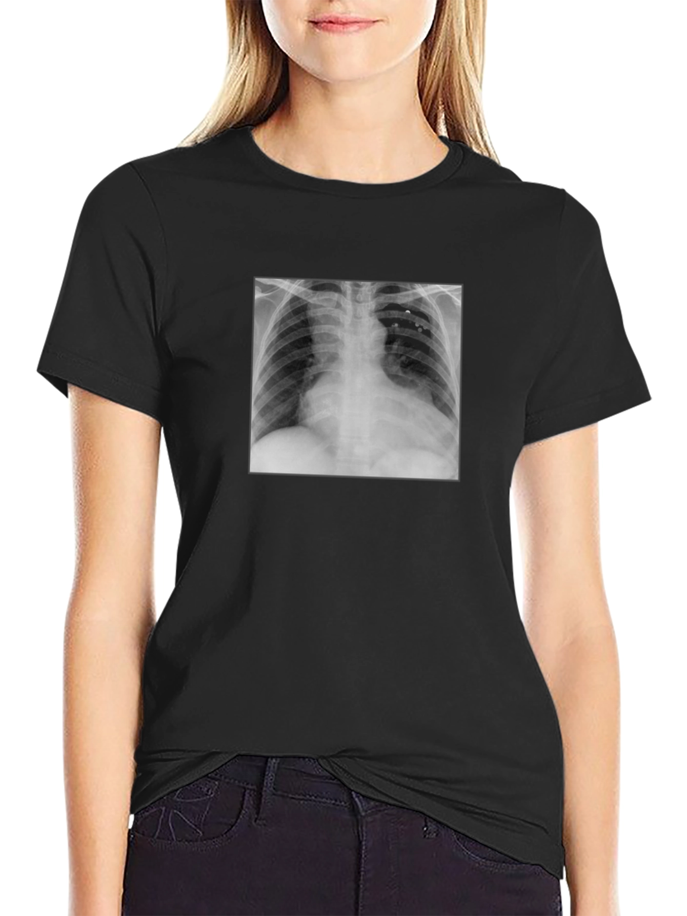 X-Ray Graphic Tee - Medical Humor T-Shirt