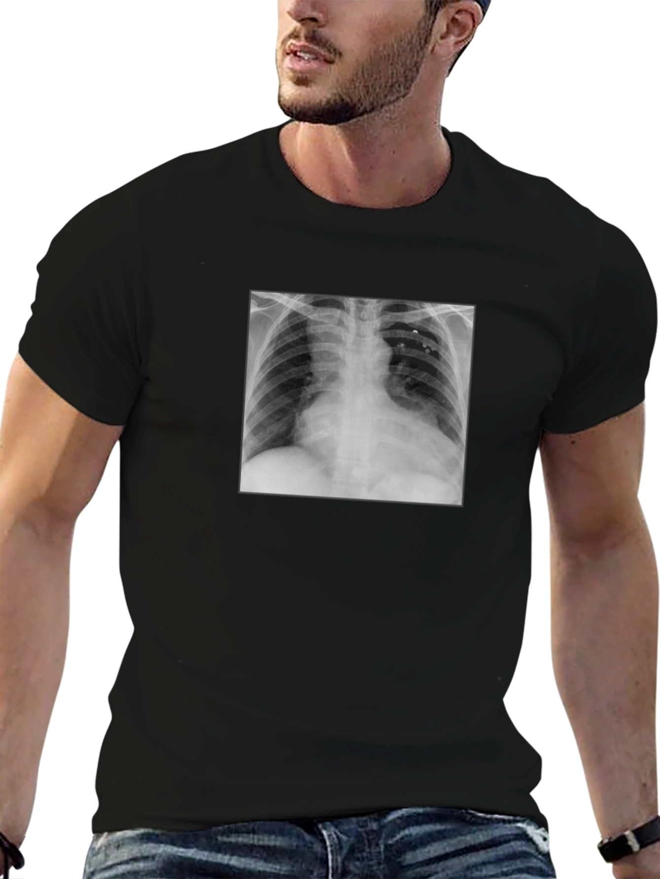 X-Ray Graphic Tee - Medical Humor T-Shirt