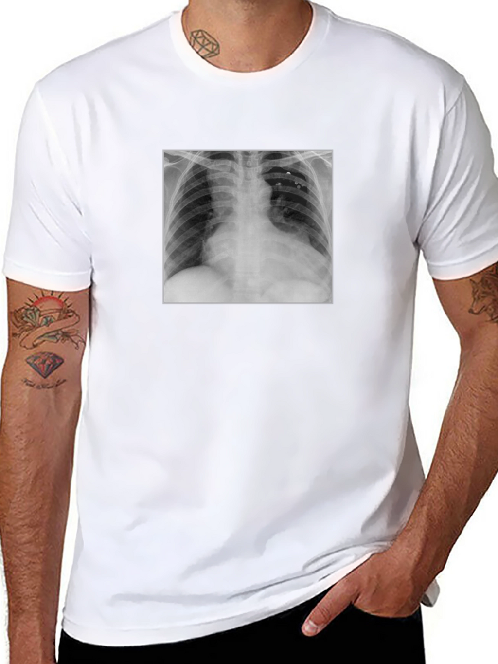 X-Ray Graphic Tee - Medical Humor T-Shirt
