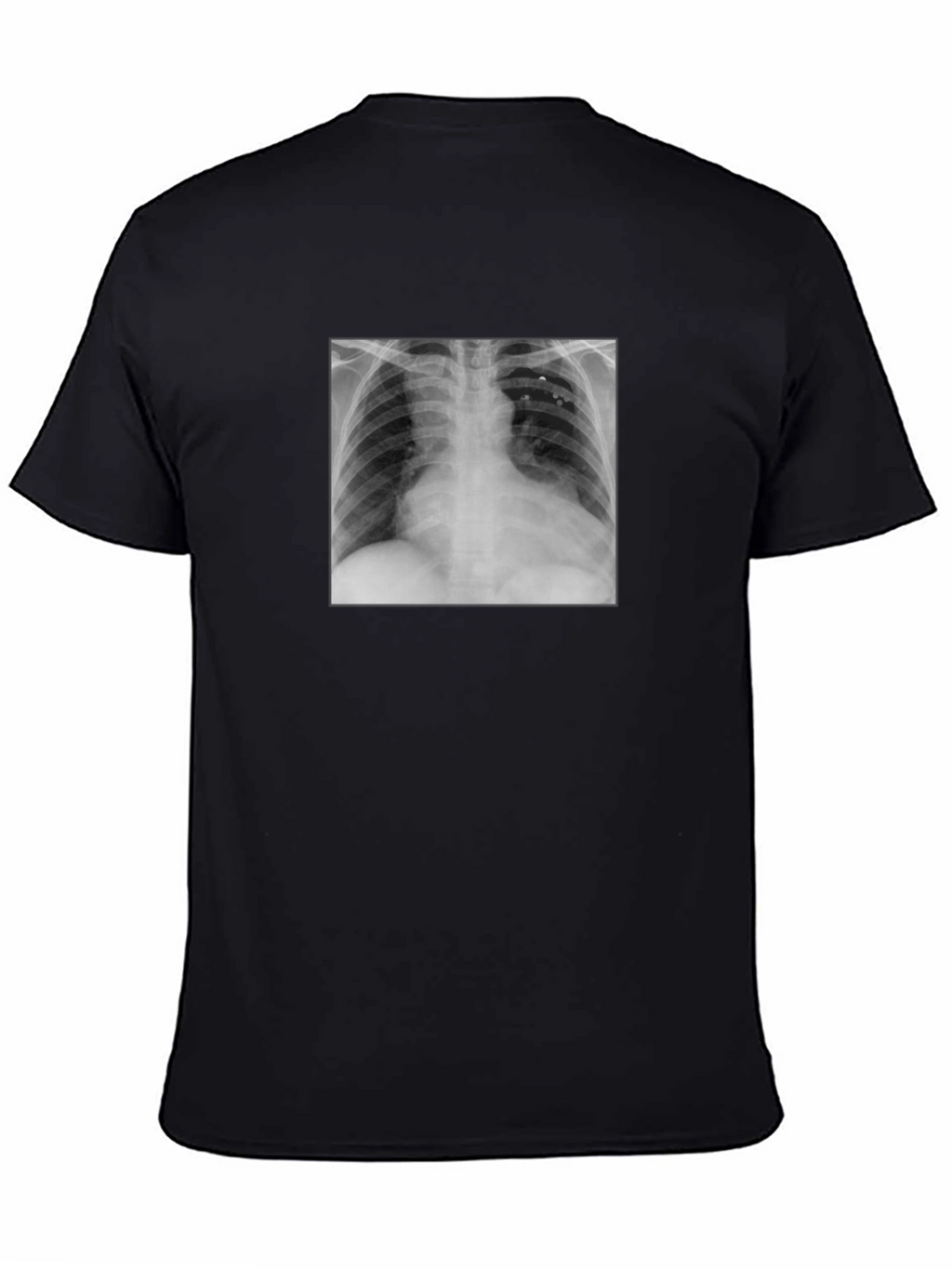 X-Ray Graphic Tee - Medical Humor T-Shirt