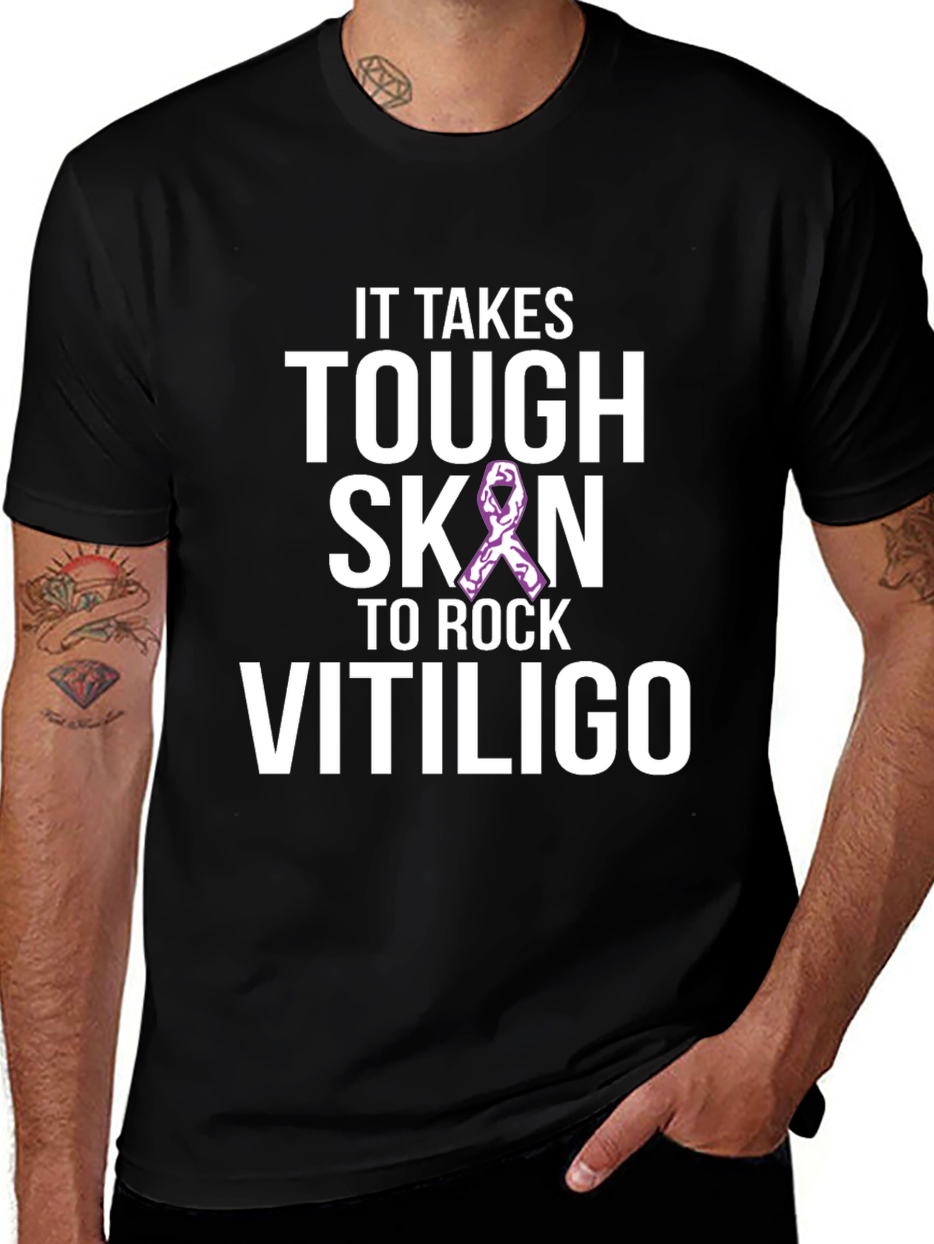Tough Skin to Rock Vitiligo Awareness T-Shirt