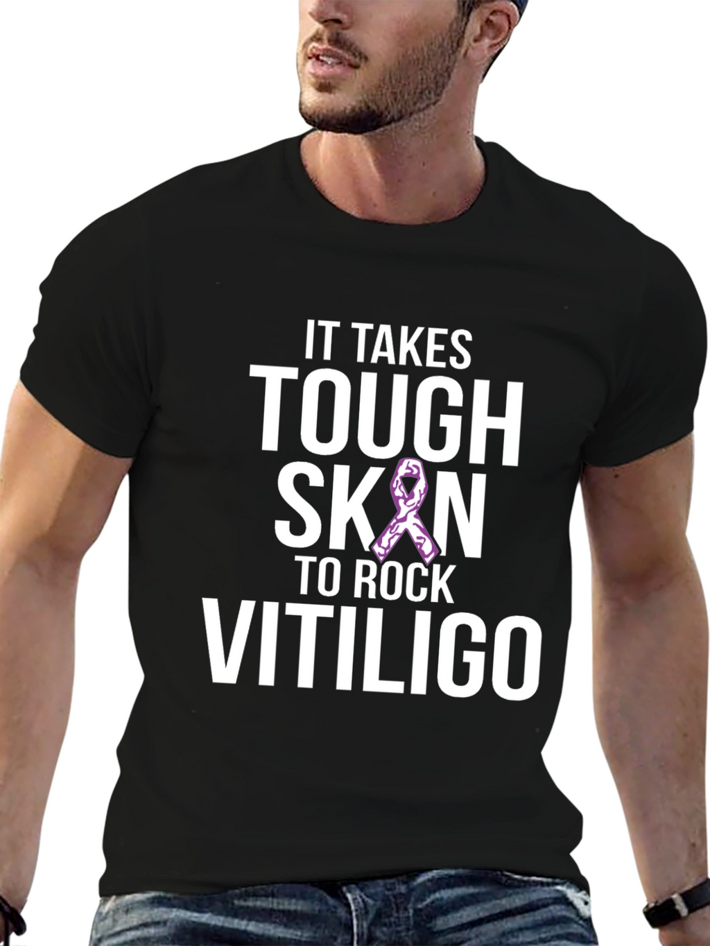 Tough Skin to Rock Vitiligo Awareness T-Shirt