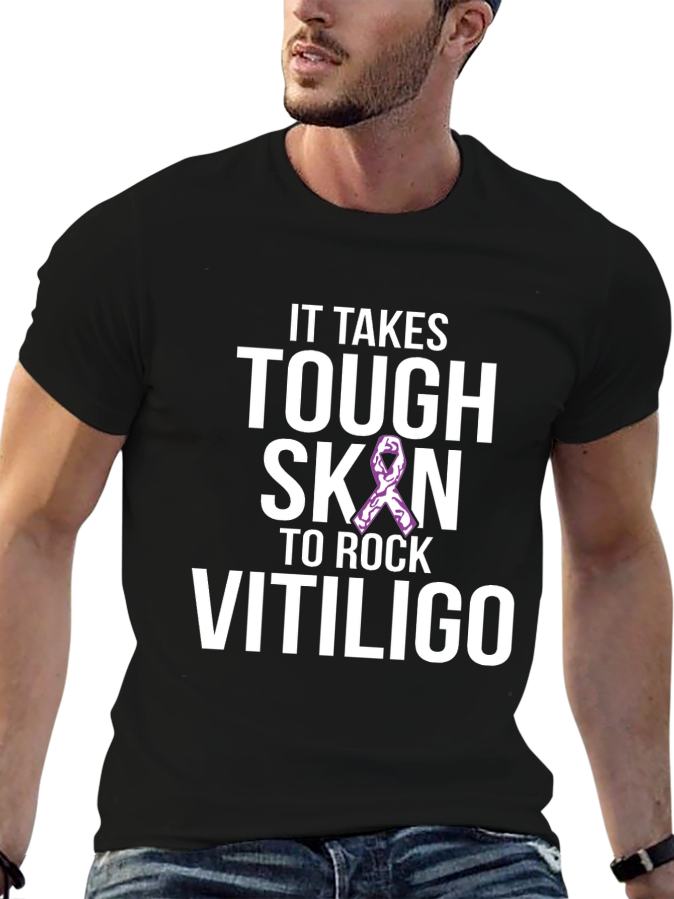 Tough Skin to Rock Vitiligo Awareness T-Shirt