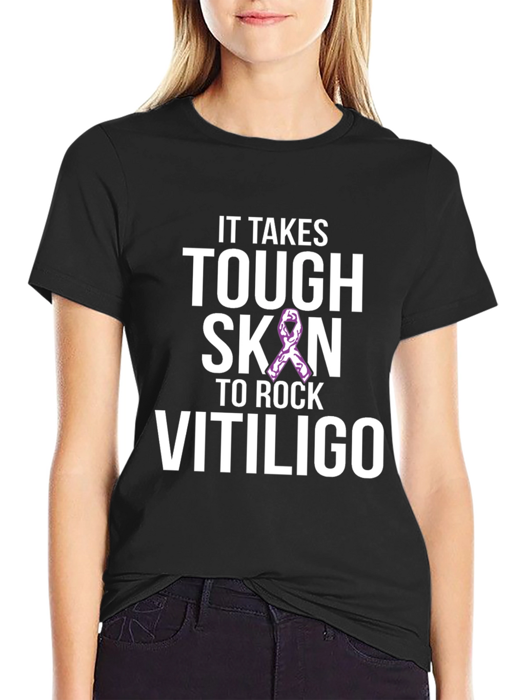 Tough Skin to Rock Vitiligo Awareness T-Shirt