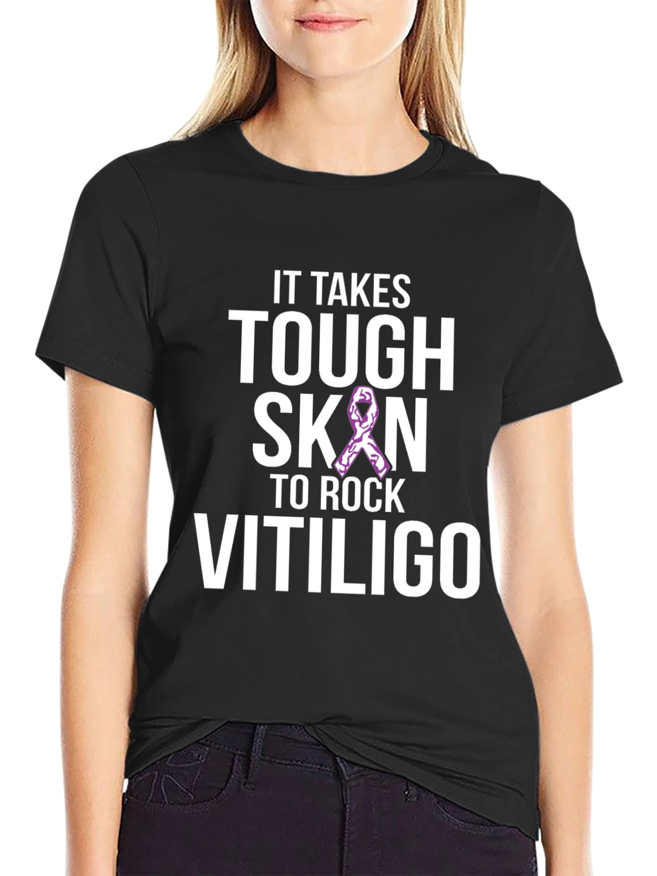 Tough Skin to Rock Vitiligo Awareness T-Shirt