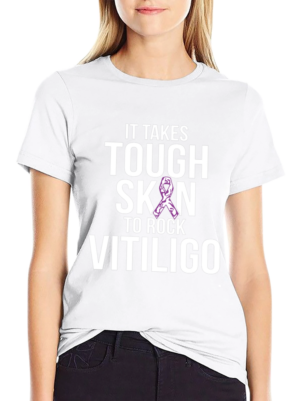 Tough Skin to Rock Vitiligo Awareness T-Shirt