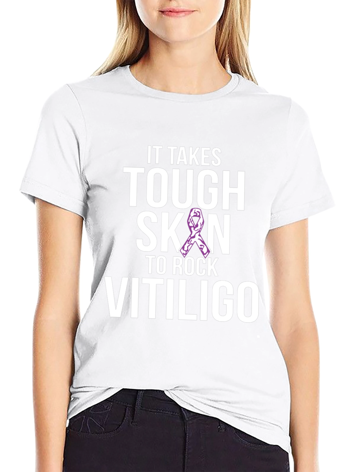 Tough Skin to Rock Vitiligo Awareness T-Shirt